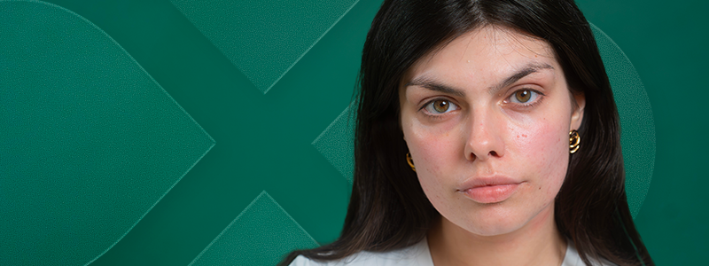 L_akne_WEB_800x300 _4 1